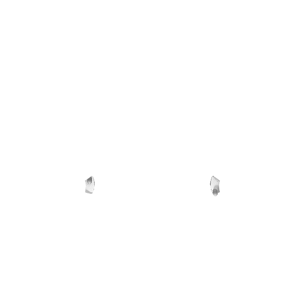 X1 Trigger Stop