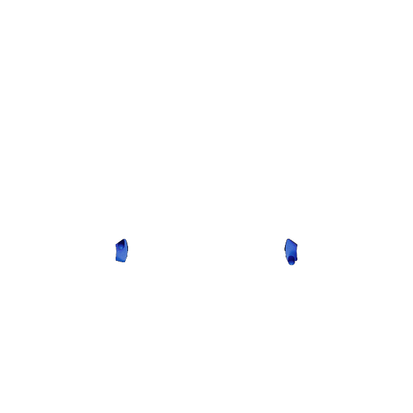 X1 Trigger Stop